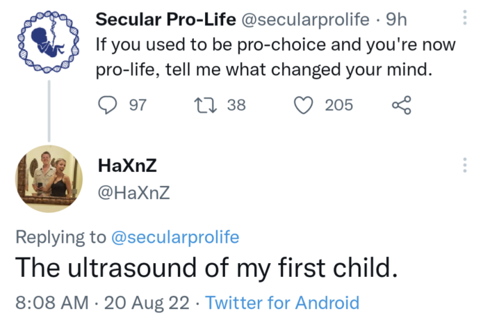 first child ultrasound