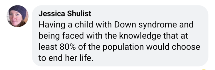 having a child with down syndrome