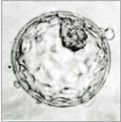 Human blastocyst, 5 to 6 days old