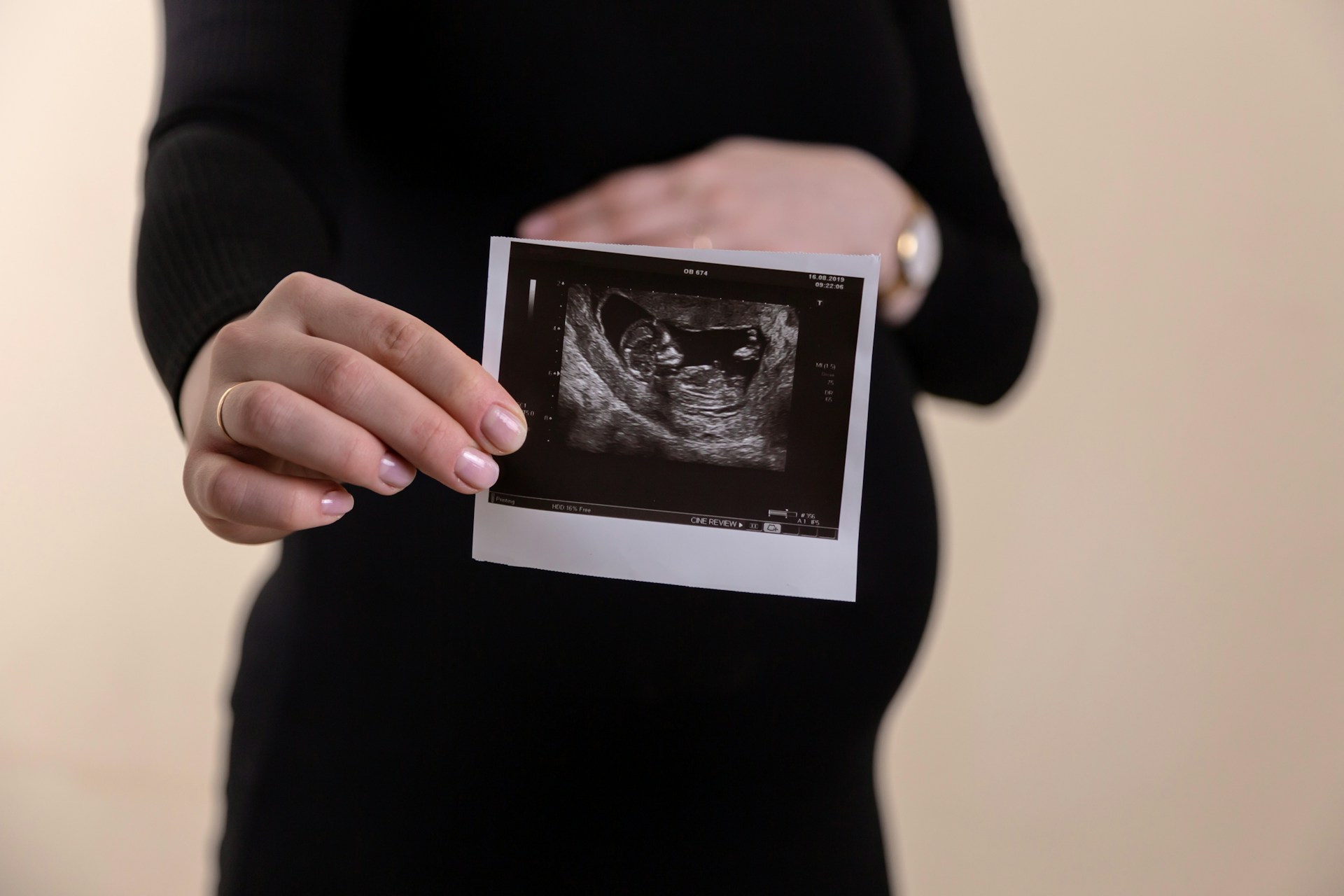 pregnant woman with ultrasound