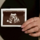 ultrasound closeup in front of pregnant woman