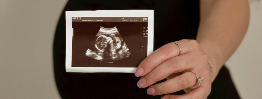 ultrasound closeup in front of pregnant woman